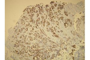 Immunohistochemistry (IHC) image for anti-Keratin 7 (KRT7) (AA 22-38), (N-Term) antibody (ABIN870434)