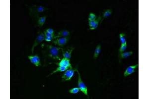 anti-Zinc Finger, DHHC-Type Containing 6 (ZDHHC6) (AA 227-409) antibody
