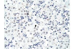 HNRPL antibody was used for immunohistochemistry at a concentration of 4-8 ug/ml to stain Hepatocytes (arrows) in Human Liver.