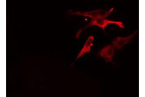 anti-Apolipoprotein A-V (APOA5) (N-Term) antibody