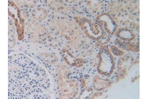 Figure. (MAPKAP Kinase 2 anticorps  (AA 139-367))