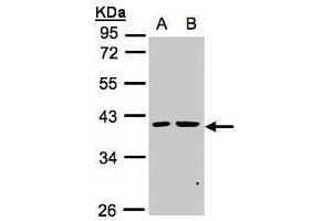 WB Image Sample(30 ug whole cell lysate) A:MOLT4 , B:Raji , 10% SDS PAGE antibody diluted at 1:1000 (PSKH2 anticorps)