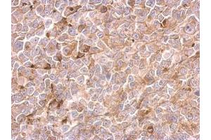 IHC-P Image Urokinase antibody detects PLAU protein at cytosol on H1299 xenograft by immunohistochemical analysis. (PLAU anticorps)