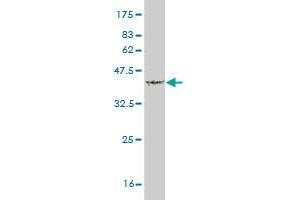 Western Blot detection against Immunogen (37.