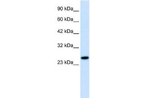 WB Suggested Anti-RGS13 Antibody Titration:  1. (RGS13 anticorps  (Middle Region))