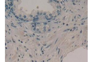 Detection of DKK1 in Human Prostate Tissue using Monoclonal Antibody to Dickkopf Related Protein 1 (DKK1)