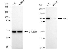 Western blotting analysis using USO1 antibody (ABIN7800775).