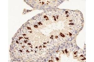 Immunohistochemistry analysis of paraffin-embedded mouse testis using,H2ab1 (ABIN7074228) at dilution of 1: 8800 (H2-AB1 anticorps)