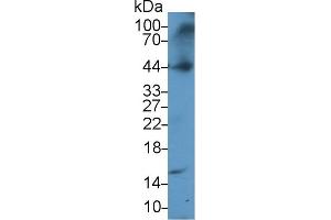 Detection of a1AGP in Rat Testis lysate using Polyclonal Antibody to Alpha-1-Acid Glycoprotein (a1AGP)