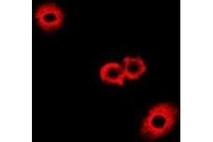 Immunofluorescent analysis of Fumarylacetoacetase staining in A549 cells. (FAH anticorps)