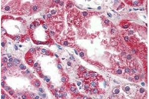 Human Kidney (formalin-fixed, paraffin-embedded) stained with PSPH antibody ABIN364329 at 10 ug/ml followed by biotinylated anti-mouse IgG secondary antibody ABIN481714, alkaline phosphatase-streptavidin and chromogen.