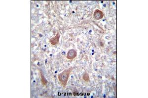 anti-Patched Domain Containing 1 (PTCHD1) (AA 611-639) antibody