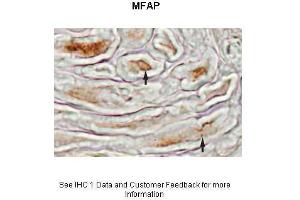 Sample Type :  Mouse sciatic nerve  Primary Antibody Dilution :  1:500  Secondary Antibody :  Biotinylated Anti-Rabbit 1:1000 followed by avidin-biotin and diaminobenzidine  Secondary Antibody Dilution :  1:1000  Gene Name :  MFAP4  Submitted by :  Beth Friedman, Ph. (MFAP4 anticorps  (N-Term))