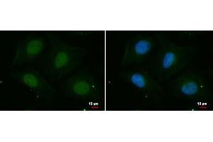 ICC/IF Image PSKH2 antibody [N2C3] detects PSKH2 protein at nucleus by immunofluorescent analysis. (PSKH2 anticorps)