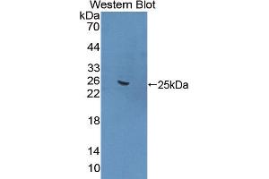 Western blot analysis of the recombinant protein. (FNBP1 anticorps  (AA 348-529))