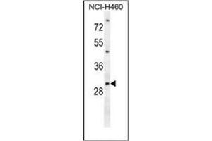 Western blot analysis of PGAM2 Antibody (N-term) in NCI-H460 cell line lysates (35ug/lane). (PGAM2 anticorps  (N-Term))