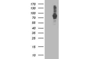 Western Blotting (WB) image for anti-phosphodiesterase 4B, cAMP-Specific (PDE4B) antibody (ABIN1500091) (PDE4B anticorps)