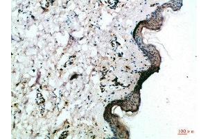 Immunohistochemical analysis of paraffin-embedded Human-skin, antibody was diluted at 1:100 (FZD4 anticorps  (AA 11-60))