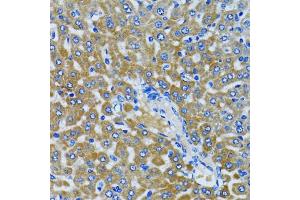 Immunohistochemistry of paraffin-embedded rat liver using HDAC5 antibody. (HDAC5 anticorps)