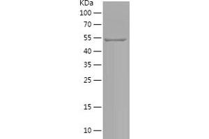 Western Blotting (WB) image for Microphthalmia-Associated Transcription Factor (MITF) (AA 1-223) protein (His-IF2DI Tag) (ABIN7123955)