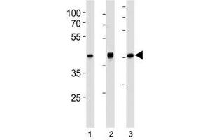 TBP antibody western blot analysis in (1) HeLa, (2) HepG2, (3) mouse NIH3T3 lysate. (TBP anticorps)