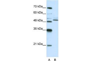 WB Suggested Anti-ZNF342 Antibody Titration:  0.