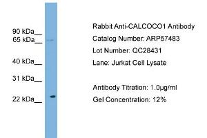 WB Suggested Anti-CALCOCO1  Antibody Titration: 0.