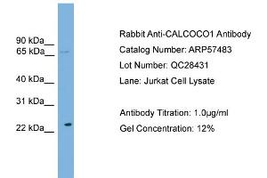 WB Suggested Anti-CALCOCO1  Antibody Titration: 0. (CALCOCO1 anticorps  (N-Term))