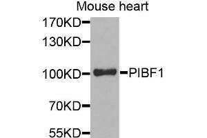 Western blot analysis of extracts of mouse heart, using PIBF1 antibody. (PIBF1 anticorps)