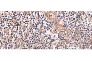 Immunohistochemistry of paraffin-embedded Human tonsil tissue using MGP Polyclonal Antibody at dilution of 1:75(x200)