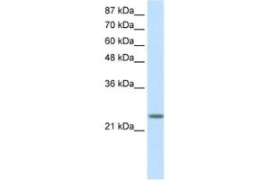 Western Blotting (WB) image for anti-MAX Dimerization Protein 3 (MXD3) antibody (ABIN2460166) (MXD3 anticorps)