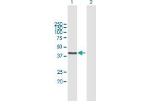 Western Blot analysis of ATAD2 expression in transfected 293T cell line by ATAD2 MaxPab polyclonal antibody. (ATAD2 anticorps  (AA 1-362))
