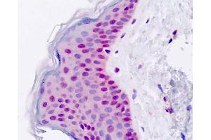 Human, Skin; Formalin-Fixed Paraffin-Embedded (FFPE)