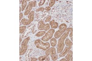 Immunohistochemical analysis of C on paraffin-embedded Human kidney tissue.