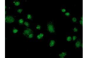 Anti-FKBPL mouse monoclonal antibody (ABIN2454034) immunofluorescent staining of COS7 cells transiently transfected by pCMV6-ENTRY FKBPL (RC202153). (FKBPL anticorps)