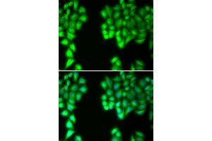 Immunofluorescence analysis of U20S cell using MALT1 antibody. (MALT1 anticorps)