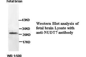 Image no. 2 for anti-Nudix (Nucleoside Diphosphate Linked Moiety X)-Type Motif 7 (NUDT7) antibody (ABIN791186) (NUDT7 anticorps)
