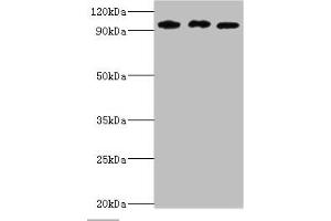 Western blot All lanes: SOX6 antibody at 10 μg/mL Lane 1: Jurkat whole cell lysate Lane 2: Hela whole cell lysate Lane 3: 293T whole cell lysate Secondary Goat polyclonal to rabbit IgG at 1/10000 dilution Predicted band size: 92, 90, 89 kDa Observed band size: 92 kDa