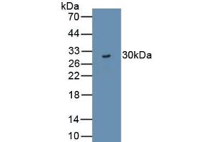 Detection of Recombinant TJP3, Rat using Polyclonal Antibody to Tight Junction Protein 3 (TJP3)