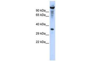 Image no. 1 for anti-Ribonuclease T2 (RNASET2) (AA 107-156) antibody (ABIN6740327) (RNASET2 anticorps  (AA 107-156))