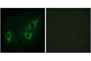 Immunofluorescence analysis of HeLa cells, using ATP7B Antibody. (ATP7B anticorps  (AA 161-210))