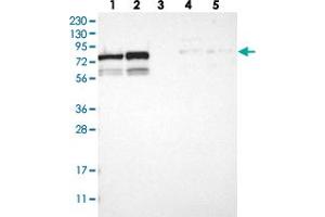 Western blot analysis of Lane 1: RT-4, Lane 2: U-251 MG, Lane 3: Human Plasma, Lane 4: Liver, Lane 5: Tonsil with MTA2 polyclonal antibody  at 1:250-1:500 dilution. (MTA2 anticorps)