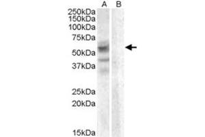 ARSD polyclonal antibody  (0. (Arylsulfatase D anticorps)