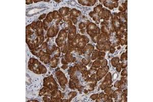 Immunohistochemical staining of human pancreas with HDLBP polyclonal antibody  shows strong cytoplasmic positivity in exocrine glandular cells. (HDLBP anticorps)