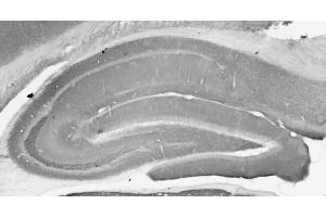 anti-Glutamate Receptor, Metabotropic 5/1 (mGluR1/5) (AA 824-1203), (C-Term), (Cytosolic) antibody