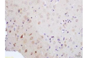 Formalin-fixed and paraffin embedded rat brain tissue labeled with Rabbit Anti-Vitamin D3 Receptor Polyclonal Antibody, Unconjugated (ABIN2559664) at 1:200 followed by conjugation to the secondary antibody and DAB staining (Vitamin D Receptor anticorps  (AA 51-150))