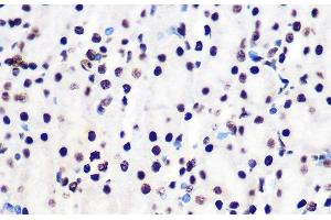 Immunohistochemistry of paraffin-embedded Mouse kidney using Phospho-Smad2(S465/467)/Smad3(S423/425) Polyclonal Antibody at dilution of 1:100 40x lens).