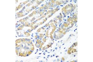 Immunohistochemistry of paraffin-embedded human stomach using MSRB2 antibody at dilution of 1:100 (40x lens). (MSRB2 anticorps)