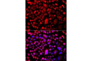 Immunofluorescence analysis of A549 cell using TP53BP2 antibody. (TP53BP2 anticorps)