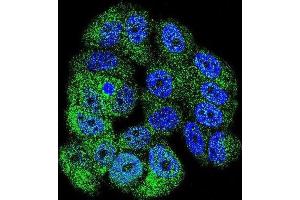 Immunofluorescence (IF) image for anti-C-Abl Oncogene 1, Non-Receptor tyrosine Kinase (ABL1) antibody (ABIN3003438) (ABL1 anticorps)
